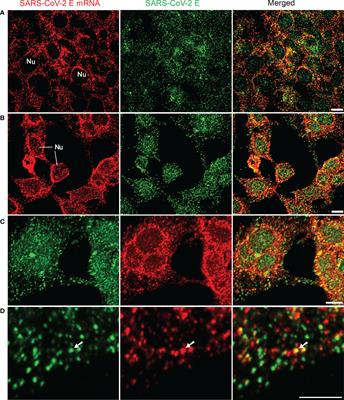 Development of a high-sensitivity and short-duration fluorescence in situ hybridization method for viral mRNA detection in HEK 293T cells